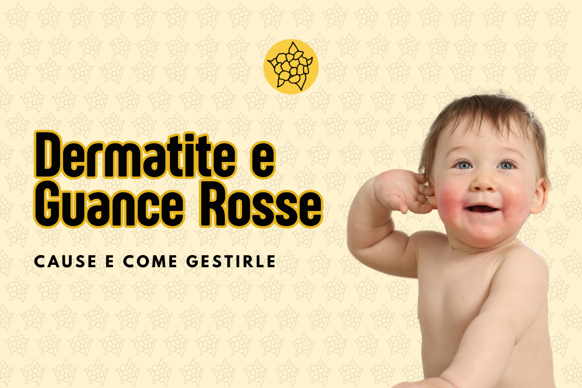 Dermatite e Guance Rosse nei Bambini: Cause e Come Gestirle al Meglio