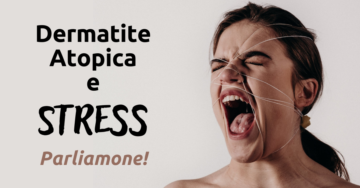 Dermatite Atopica: come lo stress danneggia la pelle
