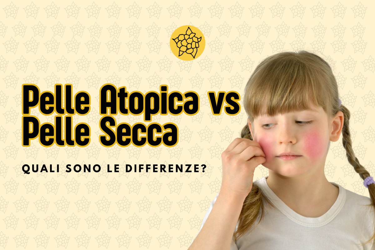 pelle atopica e pelle secca
