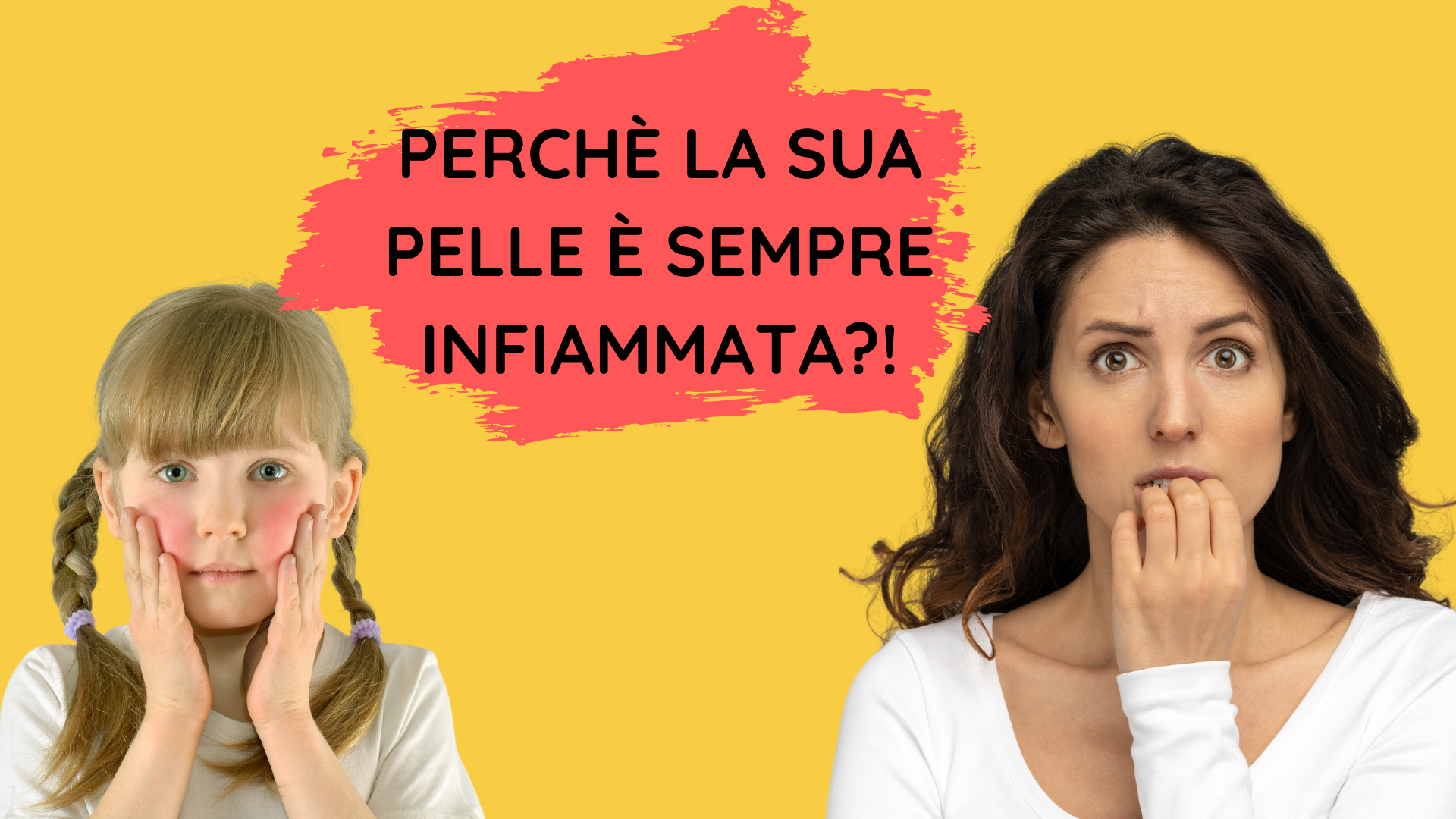 Perchè la sua pelle è sempre infiammata. Bimba con pelle rossa e mamma preoccupata