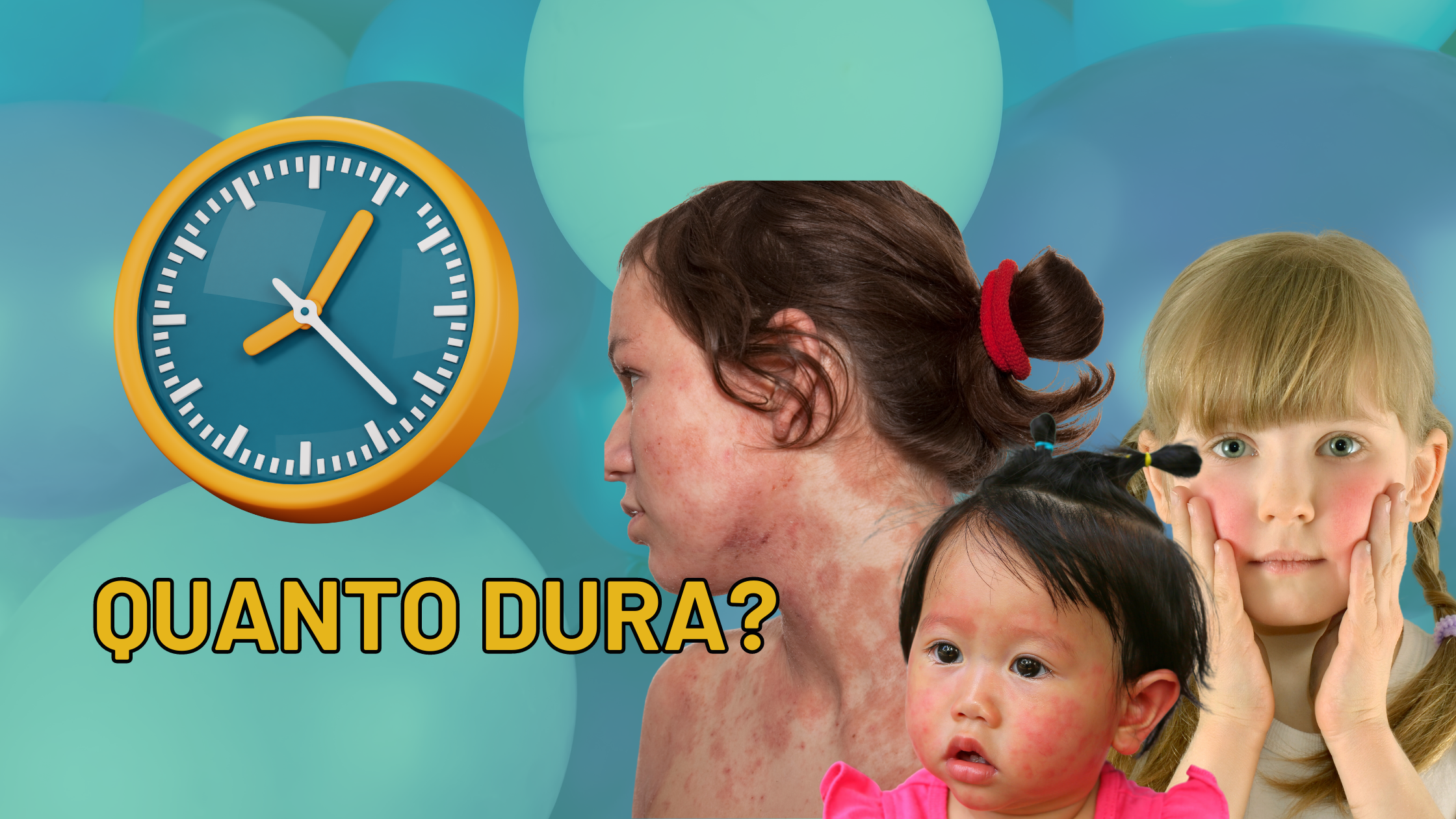 Dermatite Atopica nei Bambini: Durata della Condizione e Miti da Sfatare