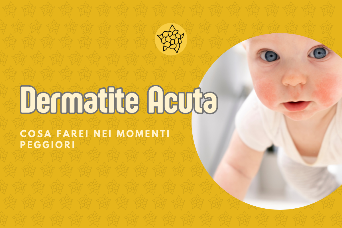 dermatite acuta