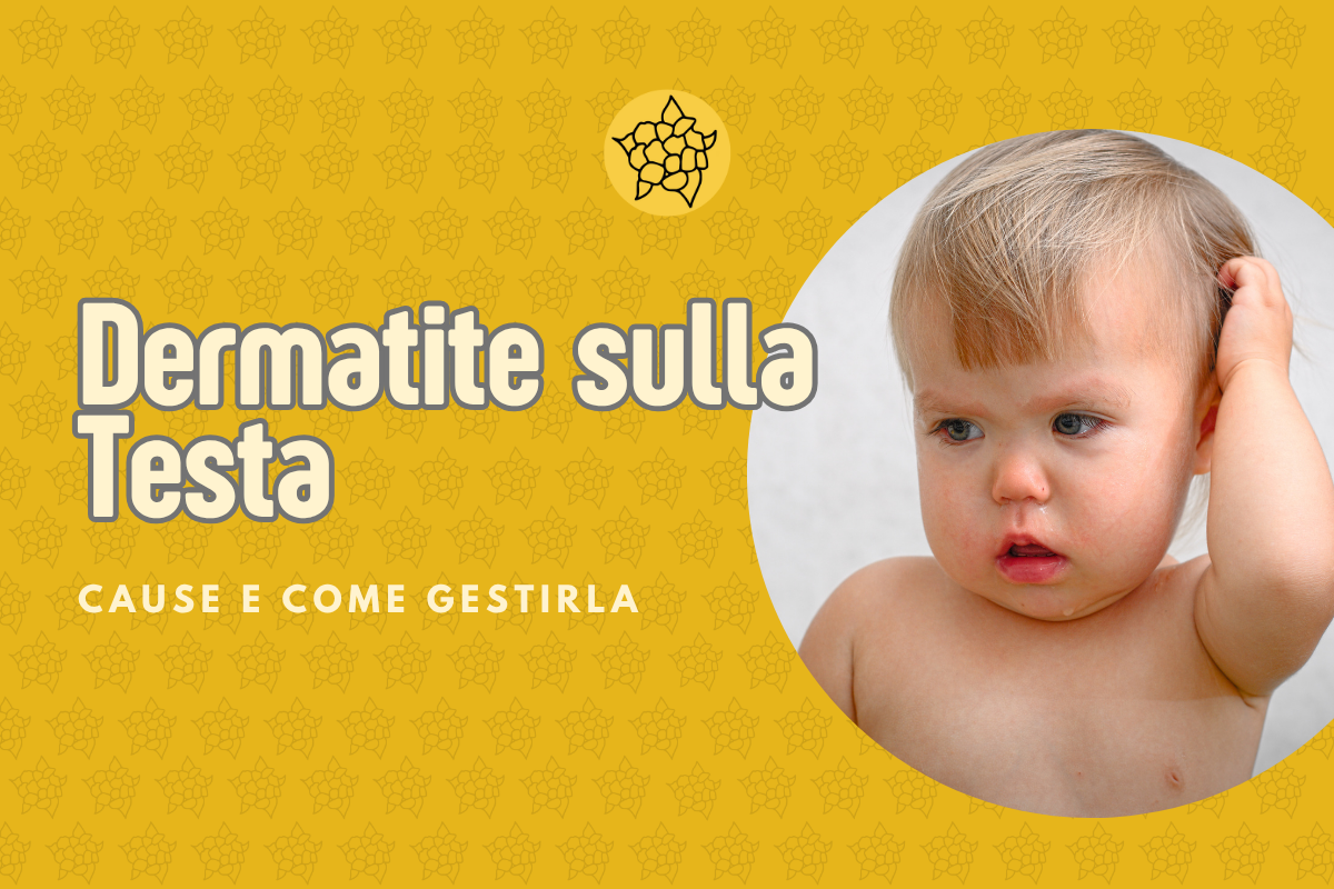 dermatite testa